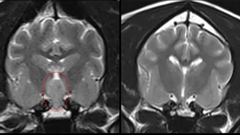 MRI images of a dogs brain before and after successful surgery to remove a pituitary tumour